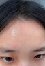 閉口粉刺克星逆光疹臉上起小疙瘩粗糙顆粒感額頭祛痘毛周角化癥 1盒【強(qiáng)力祛痘 溫和護(hù)膚】 曬單實(shí)拍圖