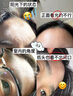 簡(jiǎn)單葉子（Leaf Simple）Leaf Simple簡(jiǎn)單葉子水楊酸棉片祛痘痘印改善粉刺控油收縮毛孔抗 0.5%日常型水楊酸[用后需補水] 曬單實(shí)拍圖