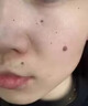 久燃遠紅外前列腺理療貼適用前列腺消炎/消腫/止痛尿頻尿急尿不暢癥狀 3盒療程裝 曬單實拍圖
