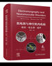 肌電圖與神經(jīng)肌肉疾病 臨床 電生理 超聲 原書(shū)第4版 曬單實(shí)拍圖