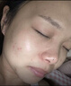 珂研凈【珂研凈祛痘凝膠】改善痘肌 清痘凈痘滋潤嫩膚珂妍凈去痘膏廠(chǎng)家 1支（建議買(mǎi)多支更劃算） 曬單實(shí)拍圖