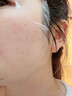 ALORMIRV法國面膜抗皺緊致抗衰老補(bǔ)水美白淡斑面膜去黃提亮膚色祛痘男女士 3盒24片【抗皺抗老新體驗(yàn)】 曬單實(shí)拍圖
