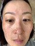 靚膚寶膠原肽升級版臻顏煥亮祛斑套盒 白里透紅美白淡斑霜十件套化妝品 升級版套裝配輔助霜 曬單實拍圖