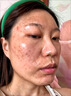 同仁堂美白祛斑面霜淡化黑色素去黃褐斑雀斑老年斑祛斑效果最好的產(chǎn)品 第2瓶半價(jià)【進(jìn)階美白 根源祛斑】 曬單實(shí)拍圖