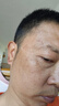 德傳公祛斑點(diǎn)斑專用霜藥水美百白淡化老年黃褐雀斑黑色素醫(yī)用正品去斑霜 買2送1【強(qiáng)力點(diǎn)痣祛斑專用膏】 祛斑效果最好的產(chǎn)品 曬單實(shí)拍圖