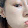 Treesymbol進口祛痘精華乳控油祛痘淡化痘印護膚平衡水油收縮毛孔保濕精華乳 祛痘精華乳 曬單實拍圖