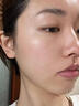 王老吉 清熱暗瘡片 清熱解毒涼血散瘀中藥內(nèi)調(diào)去痘痘治痤瘡去粉刺 5盒*24片【療程裝 】痤瘡粉刺 曬單實(shí)拍圖