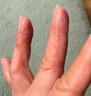 醫(yī)康方仁地松樟薄乳膏上海皮膚科醫(yī)院軟膏20gKK【藥房直售】 1支 曬單實(shí)拍圖