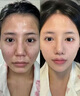 后（The history of Whoo）后小樣旅行套裝試用裝后拱辰享水妍秘貼天氣丹津率享女護膚品 后雪玉凝去角質(zhì)30片 曬單實(shí)拍圖