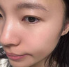 維特絲祛痘藥膏50g壬二酸水楊酸去痘痘和收毛孔閉口粉刺男女精華 曬單實(shí)拍圖