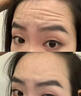 祛皺加強版祛抬頭紋魚(yú)尾紋眼下細紋美容院同款居家自用操作簡(jiǎn)單 祛皺一組 曬單實(shí)拍圖