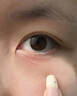 錦波生物薇旖美三型膠原4mg械字號凍干纖維號蛋白水光械三類 薇旖美4mg單支 曬單實(shí)拍圖