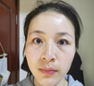 BEAUTY NOTES氨甲環(huán)酸面膜美白補水淡斑提亮膚色美白淡斑面膜保濕面膜 10片 曬單實拍圖