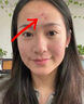 維特絲祛痘藥膏50g壬二酸水楊酸去痘痘和收毛孔閉口粉刺男女精華 曬單實(shí)拍圖
