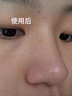fUT去黑頭導(dǎo)出液收縮毛孔精華免撕拉深層清潔粉刺閉口毛孔粗大男女士 去黑頭縮毛孔組合乳糖酸精華42ml 曬單實拍圖