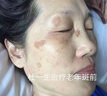 碧素堂祛斑霜美白淡化老年黃褐雀斑去斑去黑色素男士老年斑臉部手背祛斑 強(qiáng)效特效:買二送-【快速淡斑】 專用霜去老人斑淡化淡斑醫(yī)用正品 曬單實(shí)拍圖