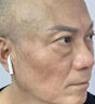 維A酸乳膏祛斑男士專用藥臉部內(nèi)調(diào)祛斑中藥臉部配排毒養(yǎng)顏i片去斑去黑色素淡化黃褐斑老年斑專用藥一夜非消 1盒裝【去斑專用醫(yī)用正品】祛斑點斑專用藥水 曬單實拍圖