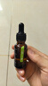 奕森祛痘精華液 無酸去痘淡痕閉口修護皮膚屏障官方店 20ml(單瓶) 曬單實拍圖