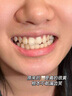 維特絲美亮白牙膏口臭去黃去牙漬去煙漬牙垢護(hù)齦清新口氣熱銷金榜第一名 曬單實拍圖