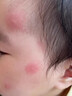 母親的故事嗡嗡斗士·精油香氛滾珠冰露舒癢清涼舒緩滾珠止癢保濕呵護肌膚 精油香氛滾珠冰露 60ml 曬單實拍圖