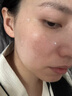 焦博士日本377祛斑霜美白淡化老年黃褐雀斑黑色素熊果苷乳膏去曬男女士 曬單實拍圖