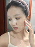 儒意（RUYI）水楊酸面膜20片祛痘淡痘印果酸控油清潔收縮毛孔女男士補水青少年 曬單實拍圖