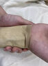 修正三角軟骨損傷膏藥貼專用貼手腕勞損疼痛扭傷膏藥護(hù)腕tfcc熱敷貼 單盒裝 曬單實(shí)拍圖