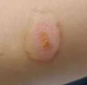 同仁堂醫(yī)用重組III型人源化膠原蛋白修復(fù)凝膠疤痕搭生長(zhǎng)因子祛痘印凝膠 曬單實(shí)拍圖
