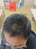 TOPPIK美國進口增發(fā)頭發(fā)纖維粉發(fā)縫補發(fā)發(fā)際線噴霧頂豐密發(fā)神器男女通用 黑色27.5克＋送優(yōu)化梳 曬單實拍圖