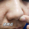 儒意黑頭導出液去黑頭收縮毛孔粉刺深層清潔黑頭清理神器美容院專用 【控油清毛孔】去黑頭水 150ml 曬單實拍圖