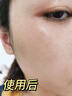 透真377美白精華液次拋淡化黑色素祛斑去黃提亮改善暗沉膚色煙酰胺女 曬單實拍圖