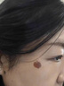 巖井昃弘祛斑點(diǎn)斑專用水藥去斑霜去黑色素臉部手背醫(yī)用正品老年斑曬斑進(jìn)口 一盒裝【日本進(jìn)口】 美白淡化黃褐雀斑黑色素男女士 曬單實(shí)拍圖