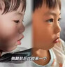打呼嚕100%治止鼾根的專(zhuān)用的藥正品打鼾專(zhuān)用藥止鼾神器貼治重度打呼嚕特專(zhuān)用效藥男女士富馬酸酮替芬片 3盒【嚴重打呼 呼吸不暢 呼嚕震天響】一片斷鼾聲 曬單實(shí)拍圖