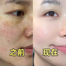EMYA美白祛斑精華液提亮淡斑煙酰胺改善暗沉膚色去黃精華液伊華同款 1盒【30ml嘗鮮裝】 曬單實拍圖