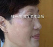 碧素堂祛斑霜美白淡化老年黃褐雀斑去斑去黑色素男士老年斑臉部手背祛斑 強(qiáng)效特效:買二送-【快速淡斑】 專用霜去老人斑淡化淡斑醫(yī)用正品 曬單實(shí)拍圖