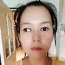 儷之康斗雞眼斜視矯正眼睛內(nèi)斜外斜訓(xùn)練器成人弱視眼貼兒童醫(yī)用葉黃素貼 熱敷眼貼買3送2 模糊重影看不清 曬單實(shí)拍圖