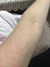 全身皮膚癢吃什么藥血熱皮膚癢用藥血熱型濕疹內(nèi)服藥皮膚紅斑瘙癢越抓越癢清熱涼血止癢藥五花茶顆粒 1盒【血熱型濕疹】建議多盒效果更佳 國藥準(zhǔn)字 正品保證 曬單實拍圖