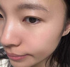 OHBT祛痘膏60g青春痘閉孔粉刺收縮毛孔專用學生男女凝膠男士化妝品 曬單實拍圖
