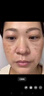 巖井昃弘祛斑霜美白淡化老年人黃褐曬雀斑去斑去黑色素男女士專用點(diǎn)斑藥水 1盒日本進(jìn)口特效純中藥祛斑霜 臉部手背效果最好的產(chǎn)品醫(yī)用正品 曬單實(shí)拍圖