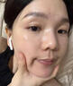 妍膚美白祛斑霜祛斑老年黃褐斑雀斑曬斑男女士專用的去斑去黑色素正品 醫(yī)用膏 20g 1盒【男女醫(yī)用】 377+577臉部手背專用霜去老人斑 曬單實(shí)拍圖