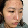 SDD水楊酸補(bǔ)水保濕面膜淡化痘印斑熬夜修護(hù)復(fù)男女抗皺緊致救急面膜 曬單實(shí)拍圖