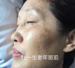 碧素堂祛斑霜美白淡化老年黃褐雀斑去斑去黑色素男士老年斑臉部手背祛斑 強(qiáng)效特效:買二送-【快速淡斑】 專用霜去老人斑淡化淡斑醫(yī)用正品 曬單實(shí)拍圖
