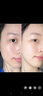 貝玲美377美白淡斑抗皺套裝祛斑去黃提亮暗沉膚色淡紋緊致精華水乳組合 【正品保障】377精華乳100g*1瓶 曬單實拍圖