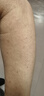 馬應龍尿素乳膏10%20g/盒 尿素軟膏尿素霜醫(yī)用尿素乳膏手腳干裂干燥手足皸裂腳后跟干裂膏角化型腳氣 曬單實拍圖