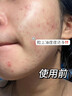 初蔓氨基酸洗面奶男女士控油祛痘除螨蟲(chóng)去黑頭深層清潔收縮毛孔潔面乳 【控油凈毛孔】維生素B5洗面奶*1支 明星推薦維生素B5洗面奶榜top 曬單實(shí)拍圖