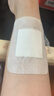 【京東護士到家】上門(mén)傷口換藥（傷口≤5cm）含醫用無(wú)菌紗布塊不含醫用傷口無(wú)菌敷貼敷料 傷口消毒促進(jìn)愈合 曬單實(shí)拍圖