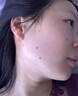dyey點痣膏無痕去痣黑痣瘊子點痣液扁平尤絲狀尤尖尤肉刺肉兒童可用 曬單實拍圖