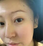 茉博士去痣點(diǎn)痣膏藥水臉部不留疤黑痣痦子溫和無痛修復(fù)液兒童成人可用 1瓶體驗(yàn)裝【無痛去痣不留疤】 曬單實(shí)拍圖