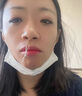 修正紅外鼻敏貼過敏性鼻竇炎成人兒童專用鼻癢塞通氣鼻炎貼膏藥貼  曬單實拍圖