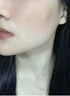 同仁堂醫(yī)用重組III型人源化膠原蛋白修復(fù)凝膠人表皮生長(zhǎng)因子祛痘印疤痕 曬單實(shí)拍圖